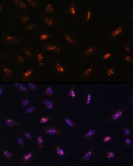Immunocytochemistry/ Immunofluorescence: LLPH Antibody - Azide and BSA Free [NBP3-04427] - Immunofluorescence analysis of U-2 OS cells using LLPH Rabbit pAb (A15534) at dilution of 1:100. Secondary antibody: Cy3 Goat Anti-Rabbit IgG (H+L) (AS007) at 1:500 dilution. Blue: DAPI for nuclear staining.