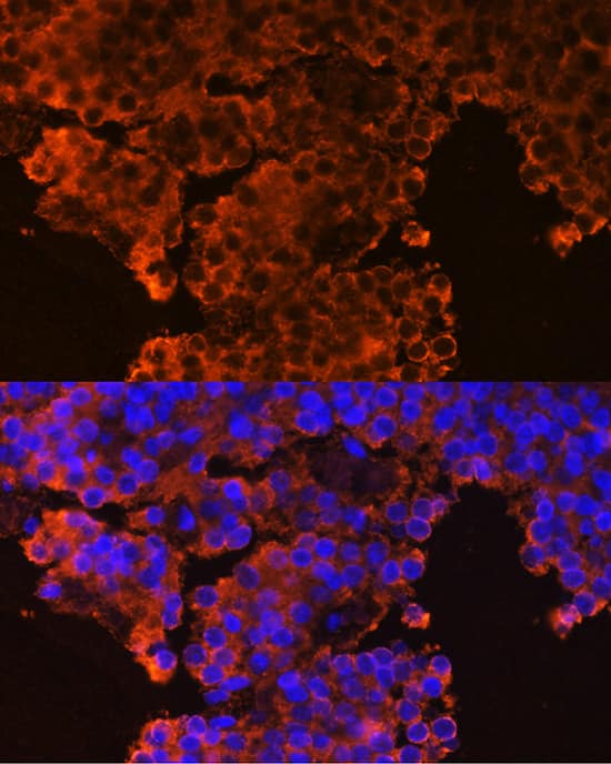 Immunocytochemistry/ Immunofluorescence GHRHR Antibody - BSA Free