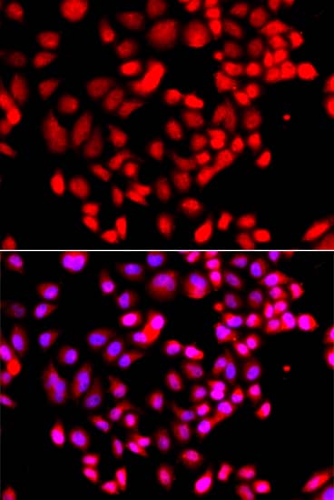 Immunocytochemistry/ Immunofluorescence: RPS6KL1 Antibody - Azide and BSA Free [RPS6KL1] - Immunofluorescence analysis of A549 cells using RPS6KL1 Rabbit pAb . Secondary antibody: Cy3-conjugated Goat anti-Rabbit IgG (H+L)  at 1:500 dilution. Blue: DAPI for nuclear staining.