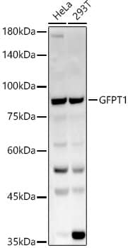 Western Blot: GFPT1 Antibody - BSA Free [NBP3-04455] - Western blot analysis of various lysates, using GFPT1 antibody (A3882) at  1:1000 dilution.Secondary antibody: HRP Goat Anti-Rabbit IgG (H+L) (AS014) at 1:10000 dilution.Lysates/proteins: 25μg per lane.Blocking buffer: 3% nonfat dry milk in TBST.Detection: ECL Basic Kit (RM00020).Exposure time: 30s.