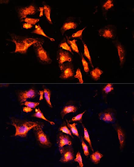 Immunocytochemistry/ Immunofluorescence: LAMTOR1 Antibody - Azide and BSA Free [NBP3-04465] - Immunofluorescence analysis of U-2 OS cells using LAMTOR1 Rabbit pAb (A11619) at dilution of 1:100 (40x lens). Secondary antibody: Cy3 Goat Anti-Rabbit IgG (H+L) (AS007) at 1:500 dilution. Blue: DAPI for nuclear staining.