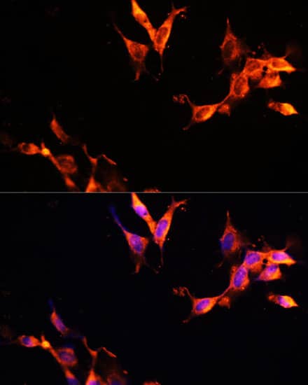 Immunocytochemistry/ Immunofluorescence: LAMTOR1 Antibody - Azide and BSA Free [NBP3-04465] - Immunofluorescence analysis of NIH-3T3 cells using LAMTOR1 Rabbit pAb (A11619) at dilution of 1:100 (40x lens). Secondary antibody: Cy3 Goat Anti-Rabbit IgG (H+L) (AS007) at 1:500 dilution. Blue: DAPI for nuclear staining.