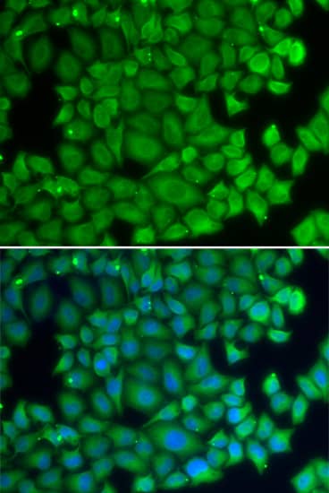 Immunocytochemistry/ Immunofluorescence: HspB2 Antibody - BSA Free [NBP3-04484] - Immunofluorescence analysis of U2OS cells using HspB2 antibody (A2350). Blue: DAPI for nuclear staining.