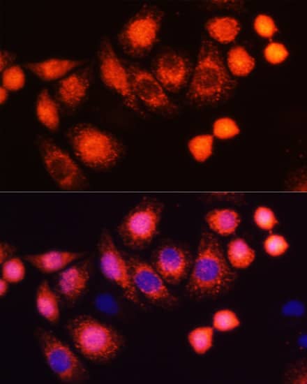 Immunocytochemistry/ Immunofluorescence: HRAS Antibody - Azide and BSA Free [NBP3-04486] - Immunofluorescence analysis of HeLa cells using HRAS Rabbit pAb (A12212) at dilution of 1:100 (40x lens). Secondary antibody: Cy3 Goat Anti-Rabbit IgG (H+L) (AS007) at 1:500 dilution. Blue: DAPI for nuclear staining.