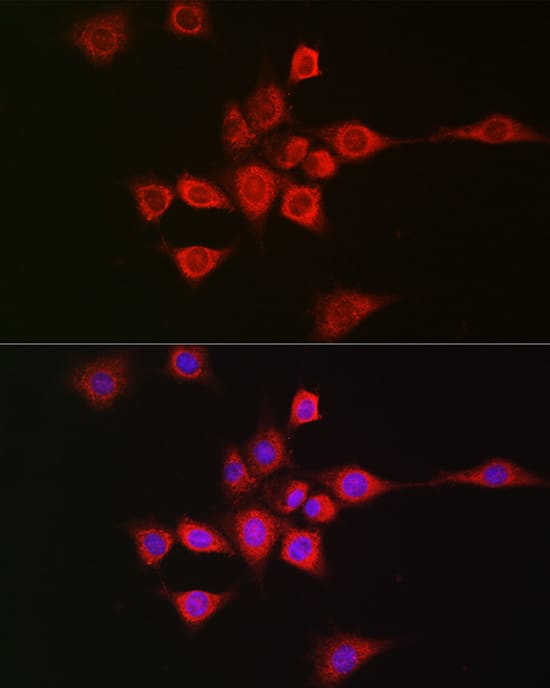 Immunocytochemistry/ Immunofluorescence: METTL4 Antibody - Azide and BSA Free [METTL4] - Immunofluorescence analysis of NIH/3T3 cells using METTL4 Rabbit pAb  at dilution of 1:50 (40x lens). Secondary antibody: Cy3 Goat Anti-Rabbit IgG (H+L)  at 1:500 dilution. Blue: DAPI for nuclear staining.