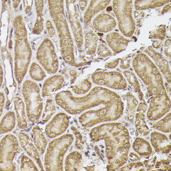 Immunohistochemistry: METTL4 Antibody - Azide and BSA Free [METTL4] - Immunohistochemistry analysis of paraffin-embedded Mouse kidney using METTL4 Rabbit pAb  at dilution of 1:50 (40x lens). Perform high pressure antigen retrieval with 10 mM citrate buffer pH 6.0 before commencing with IHC staining protocol.