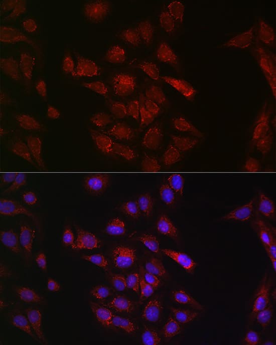 Immunocytochemistry/ Immunofluorescence: METTL4 Antibody - Azide and BSA Free [METTL4] - Immunofluorescence analysis of U2OS cells using METTL4 Rabbit pAb  at dilution of 1:50 (40x lens). Secondary antibody: Cy3 Goat Anti-Rabbit IgG (H+L)  at 1:500 dilution. Blue: DAPI for nuclear staining.