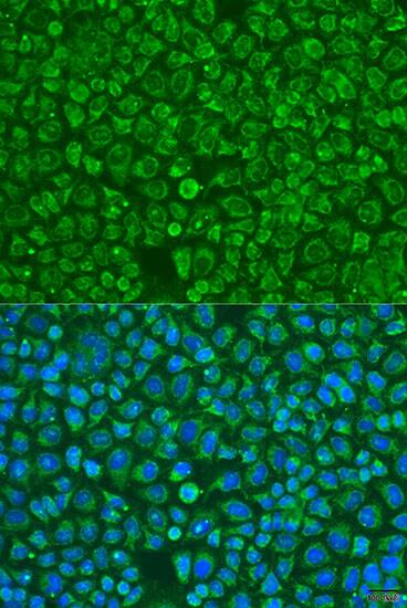 Immunocytochemistry/ Immunofluorescence: ARSF Antibody - BSA Free [NBP3-04502] - Immunofluorescence analysis of U2OS cells using ARSF Rabbit pAb (A15031) at dilution of 1:100. Secondary antibody: Cy3 Goat Anti-Rabbit IgG (H+L) (AS007) at 1:500 dilution. Blue: DAPI for nuclear staining.