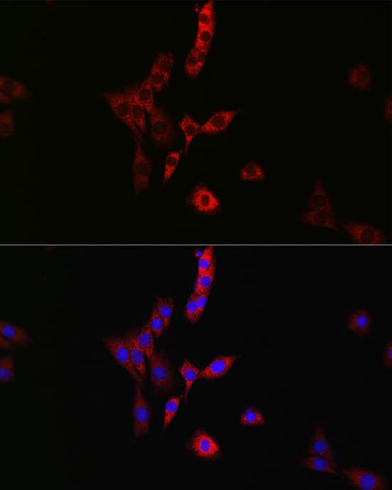 Immunocytochemistry/ Immunofluorescence: RAB35 Antibody - Azide and BSA Free [RAB35] - Immunofluorescence analysis of PC-12 cells using RAB35 Rabbit pAb  at dilution of 1:100 (40x lens). Secondary antibody: Cy3 Goat Anti-Rabbit IgG (H+L)  at 1:500 dilution. Blue: DAPI for nuclear staining.