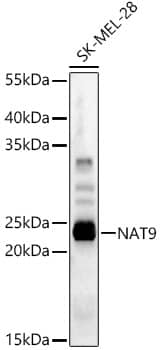 Western Blot: NAT9 Antibody - BSA Free [NBP3-04518] - Western blot analysis of lysates from SK-MEL-28 cells, using NAT9 Rabbit pAb at 1:1000 dilution.Secondary antibody: HRP-conjugated Goat anti-Rabbit IgG (H+L) at 1:10000 dilution.Lysates/proteins: 25ug per lane.Blocking buffer: 3% nonfat dry milk in TBST.Detection: ECL Basic Kit.Exposure time: 90s.