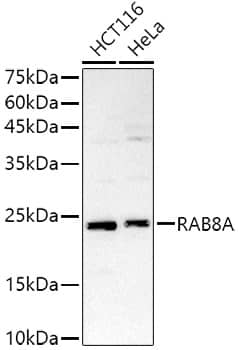 Western Blot: RAB8A Antibody - Azide and BSA Free [NBP3-04519] - Western blot analysis of extracts of various cell lines, using RAB8A antibody (A17369) at  1:500 dilution.Secondary antibody: HRP Goat Anti-Rabbit IgG (H+L) (AS014) at 1:10000 dilution.Lysates/proteins: 25μg per lane.Blocking buffer: 3% nonfat dry milk in TBST.Detection: ECL Basic Kit (RM00020).Exposure time: 180s.