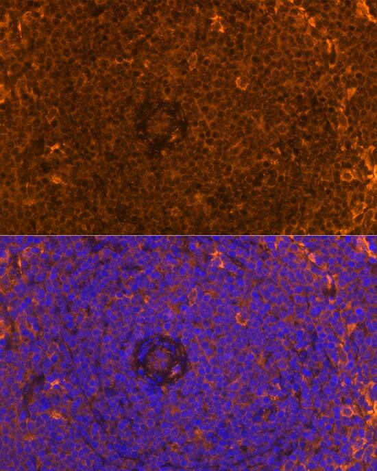 Immunocytochemistry/ Immunofluorescence: FAM65B Antibody - Azide and BSA Free [NBP3-04522] - Immunofluorescence analysis of paraffin-embedded Rat spleen using FAM65B Rabbit pAb (A9234) at dilution of 1:100. Secondary antibody: Cy3 Goat Anti-Rabbit IgG (H+L) (AS007) at 1:500 dilution. Blue: DAPI for nuclear staining.
