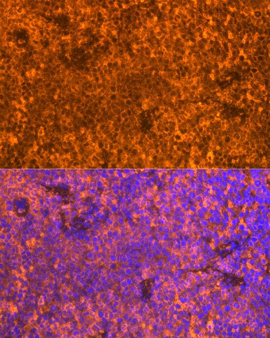 Immunocytochemistry/ Immunofluorescence: FAM65B Antibody - Azide and BSA Free [NBP3-04522] - Immunofluorescence analysis of paraffin-embedded Mouse spleen using FAM65B Rabbit pAb (A9234) at dilution of 1:100. Secondary antibody: Cy3 Goat Anti-Rabbit IgG (H+L) (AS007) at 1:500 dilution. Blue: DAPI for nuclear staining.