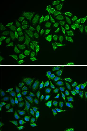 Immunocytochemistry/ Immunofluorescence RhoD Antibody - Azide and BSA Free