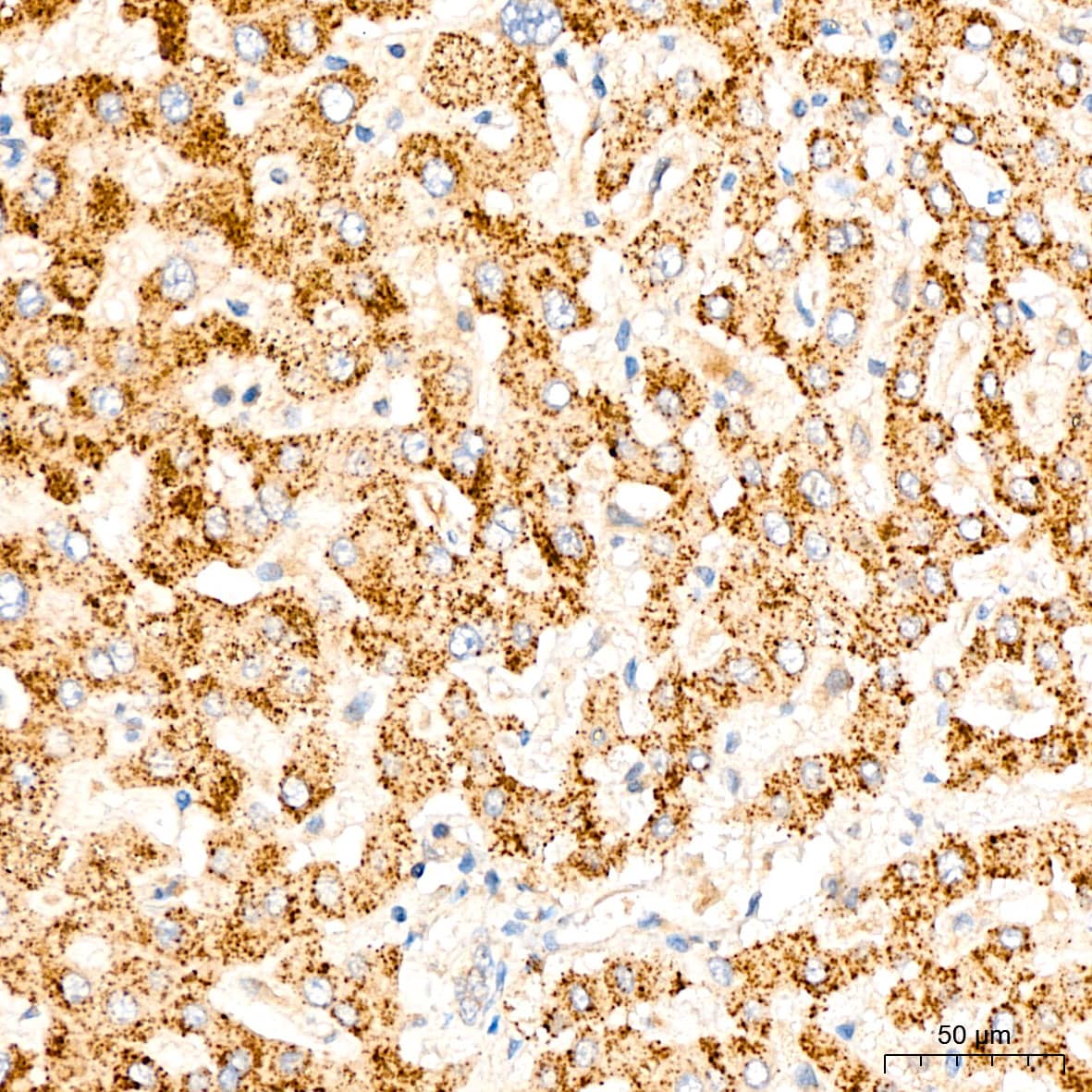 Immunohistochemistry: GRPEL1 Antibody - BSA Free [NBP3-04531] - Immunohistochemistry analysis of GRPEL1 in paraffin-embedded Human liver tissue using GRPEL1 Rabbit pAb (A4999) at a dilution of  1:100 (40x lens). High pressure antigen retrieval was performed with 0.01 M citrate buffer (pH 6.0) prior to IHC staining.
