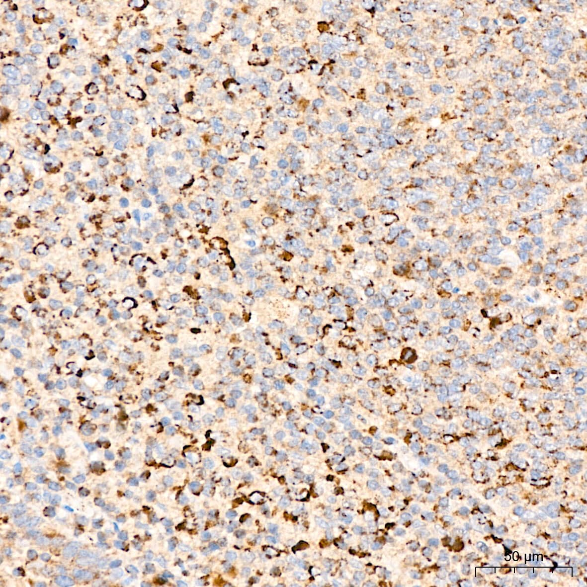 Immunohistochemistry: GRPEL1 Antibody - BSA Free [NBP3-04531] - Immunohistochemistry analysis of GRPEL1 in paraffin-embedded Human tonsil tissue using GRPEL1 Rabbit pAb (A4999) at a dilution of  1:100 (40x lens). High pressure antigen retrieval was performed with 0.01 M citrate buffer (pH 6.0) prior to IHC staining.