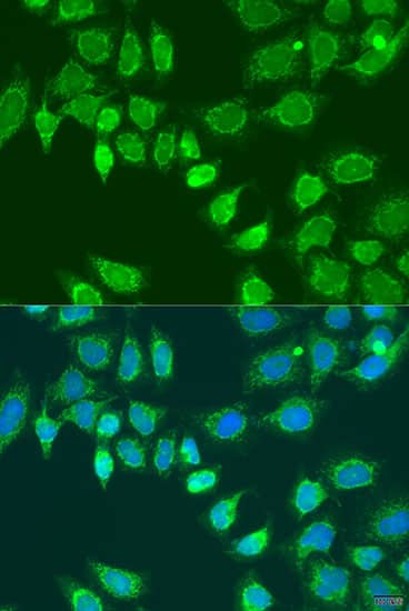 Immunocytochemistry/ Immunofluorescence: L2HGDH Antibody - BSA Free [L2HGDH] - Immunofluorescence analysis of U2OS cells using L2HGDH Rabbit pAb  at dilution of 1:100. Secondary antibody: Cy3-conjugated Goat anti-Rabbit IgG (H+L)  at 1:500 dilution. Blue: DAPI for nuclear staining.