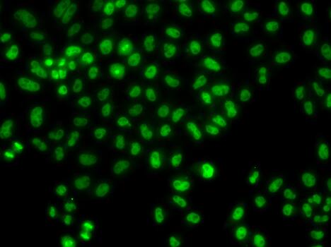 Immunocytochemistry/ Immunofluorescence: Lhx8 Antibody - BSA Free [Lhx8] - Immunofluorescence analysis of HeLa cells using Lhx8 Rabbit pAb .Secondary antibody: Cy3-conjugated Goat anti-Rabbit IgG (H+L)  at 1:500 dilution.