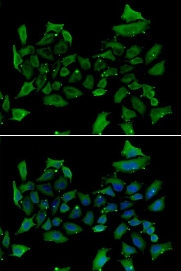 Immunocytochemistry/ Immunofluorescence: Alas1 Antibody - BSA Free [NBP3-04580] - Immunofluorescence analysis of HeLa cells using Alas1 antibody (A13462). Blue: DAPI for nuclear staining.