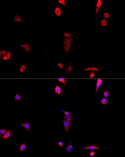 Immunocytochemistry/ Immunofluorescence: EIF3J Antibody - Azide and BSA Free [NBP3-04592] - Immunofluorescence analysis of NIH/3T3 cells using EIF3J Rabbit pAb (A8637) at dilution of 1:100. Secondary antibody: Cy3 Goat Anti-Rabbit IgG (H+L) (AS007) at 1:500 dilution. Blue: DAPI for nuclear staining.