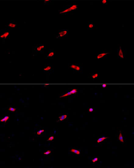 Immunocytochemistry/ Immunofluorescence: EIF3J Antibody - Azide and BSA Free [NBP3-04592] - Immunofluorescence analysis of PC-12 cells using EIF3J Rabbit pAb (A8637) at dilution of 1:100. Secondary antibody: Cy3 Goat Anti-Rabbit IgG (H+L) (AS007) at 1:500 dilution. Blue: DAPI for nuclear staining.