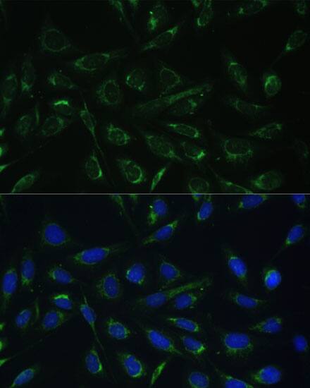 Immunocytochemistry/ Immunofluorescence: HCCS Antibody - BSA Free [NBP3-04609] - Immunofluorescence analysis of U-2 OS cells using HCCS Polyclonal Antibody (A7490) at dilution of 1:100 (40x lens). Blue: DAPI for nuclear staining.