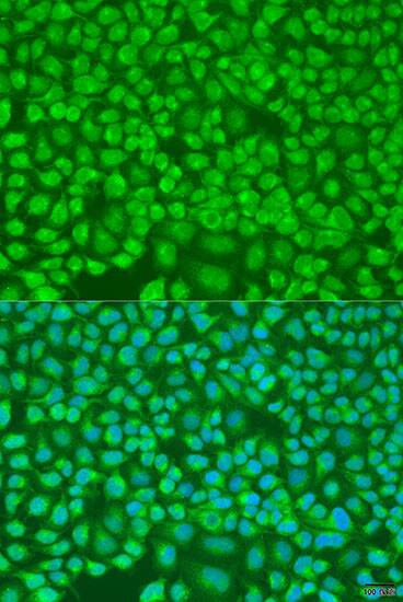 Immunocytochemistry/ Immunofluorescence: PNKD Antibody - BSA Free [NBP3-04617] - Immunofluorescence analysis of U2OS cells using PNKD antibody (A8203) at dilution of 1:100. Blue: DAPI for nuclear staining.