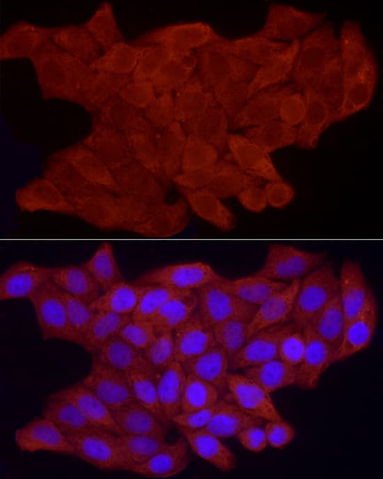 Immunocytochemistry/ Immunofluorescence FHL3 Antibody - BSA Free