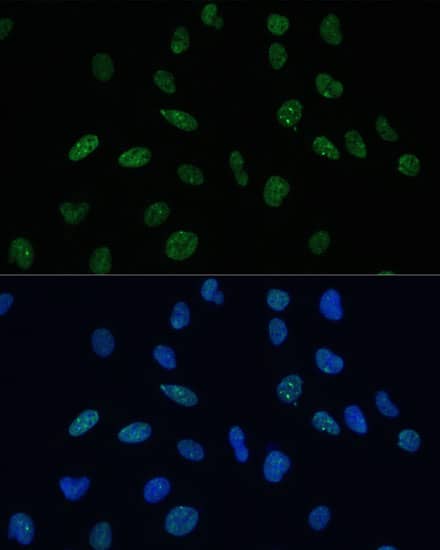 Immunocytochemistry/ Immunofluorescence: Mkl1 Antibody - BSA Free [Mkl1] - Immunofluorescence analysis of U-2 OS cells using Mkl1 Rabbit pAb  at dilution of 1:100 (40x lens). Secondary antibody: Cy3 Goat Anti-Rabbit IgG (H+L)  at 1:500 dilution. Blue: DAPI for nuclear staining.