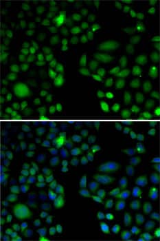 Immunocytochemistry/ Immunofluorescence: EPC1 Antibody - BSA Free [NBP3-04636] - Immunofluorescence analysis of U2OS cells using EPC1 antibody (A5807). Blue: DAPI for nuclear staining.