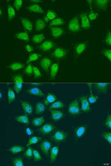 Immunocytochemistry/ Immunofluorescence: EYA3 Antibody - BSA Free [NBP3-04637] - Immunofluorescence analysis of U2OS cells using EYA3 antibody (A15056) at dilution of 1:100. Blue: DAPI for nuclear staining.