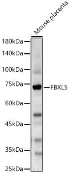 Western Blot: FBXL5 Antibody - BSA Free [NBP3-04665] - Western blot analysis of various lysates, using FBXL5 Rabbit pAb (A5602) at 1:1000 dilution.Secondary antibody: HRP Goat Anti-Rabbit IgG (H+L) (AS014) at 1:10000 dilution.Lysates/proteins: 25μg per lane.Blocking buffer: 3% nonfat dry milk in TBST.Detection: ECL Basic Kit (RM00020).Exposure time: 90s.