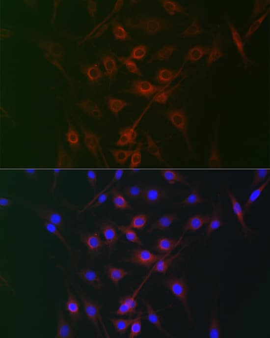 Immunocytochemistry/ Immunofluorescence RRAGA Antibody - Azide and BSA Free