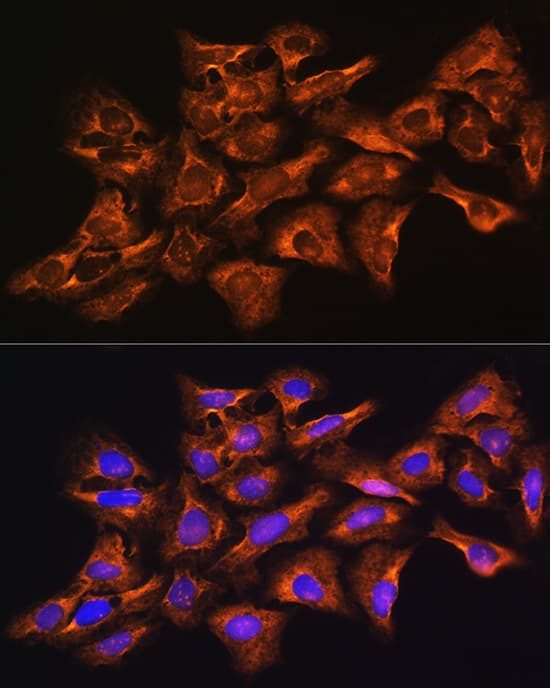 Immunocytochemistry/ Immunofluorescence: GNB1 Antibody - BSA Free [NBP3-04689] - Immunofluorescence analysis of U-2 OS cells using GNB1 Rabbit pAb (A1867) at dilution of 1:100 (40x lens). Blue: DAPI for nuclear staining.
