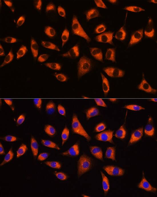 Immunocytochemistry/ Immunofluorescence: GNB2 Antibody - BSA Free [GNB2] - Immunofluorescence analysis of L929 cells using GNB2 Rabbit pAb  at dilution of 1:100 (40x lens). Secondary antibody: Cy3 Goat Anti-Rabbit IgG (H+L)  at 1:500 dilution. Blue: DAPI for nuclear staining.