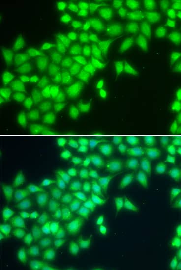 Immunocytochemistry/ Immunofluorescence: METTL2A Antibody - BSA Free [NBP3-04709] - Immunofluorescence analysis of MCF-7 cells using METTL2A antibody (A14166). Blue: DAPI for nuclear staining.