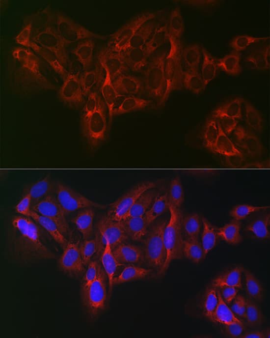 Immunocytochemistry/ Immunofluorescence: eIF4A1 Antibody - Azide and BSA Free [eIF4A1] - Immunofluorescence analysis of U2OS cells using eIF4A1 Rabbit pAb  at dilution of 1:100 (40x lens). Secondary antibody: Cy3-conjugated Goat anti-Rabbit IgG (H+L)  at 1:500 dilution. Blue: DAPI for nuclear staining.