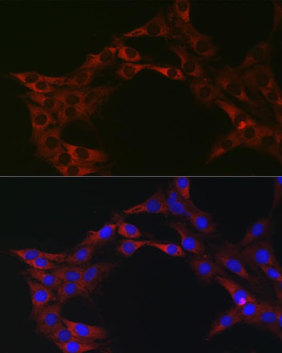 Immunocytochemistry/ Immunofluorescence: eIF4A1 Antibody - Azide and BSA Free [eIF4A1] - Immunofluorescence analysis of C6 cells using eIF4A1 Rabbit pAb  at dilution of 1:100 (40x lens). Secondary antibody: Cy3-conjugated Goat anti-Rabbit IgG (H+L)  at 1:500 dilution. Blue: DAPI for nuclear staining.