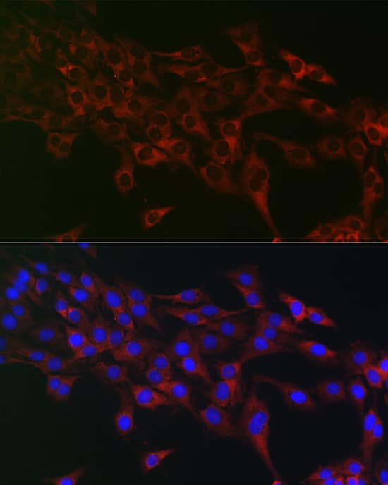 Immunocytochemistry/ Immunofluorescence: eIF4A1 Antibody - Azide and BSA Free [eIF4A1] - Immunofluorescence analysis of C6 cells using eIF4A1 Rabbit pAb  at dilution of 1:100 (40x lens). Secondary antibody: Cy3-conjugated Goat anti-Rabbit IgG (H+L)  at 1:500 dilution. Blue: DAPI for nuclear staining.