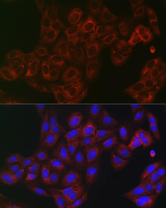 Immunocytochemistry/ Immunofluorescence: eIF4A1 Antibody - Azide and BSA Free [eIF4A1] - Immunofluorescence analysis of U2OS cells using eIF4A1 Rabbit pAb  at dilution of 1:100 (40x lens). Secondary antibody: Cy3-conjugated Goat anti-Rabbit IgG (H+L)  at 1:500 dilution. Blue: DAPI for nuclear staining.