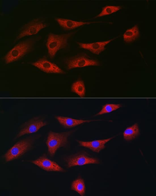 Immunocytochemistry/ Immunofluorescence: eIF4A1 Antibody - Azide and BSA Free [eIF4A1] - Immunofluorescence analysis of NIH/3T3 cells using eIF4A1 Rabbit pAb  at dilution of 1:100 (40x lens). Secondary antibody: Cy3-conjugated Goat anti-Rabbit IgG (H+L)  at 1:500 dilution. Blue: DAPI for nuclear staining.