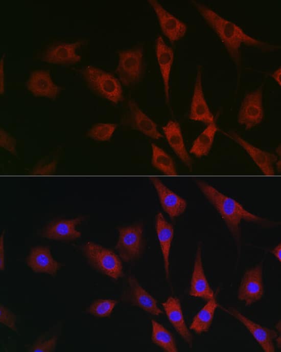 Immunocytochemistry/ Immunofluorescence: eIF4A1 Antibody - Azide and BSA Free [eIF4A1] - Immunofluorescence analysis of NIH/3T3 cells using eIF4A1 Rabbit pAb  at dilution of 1:100 (40x lens). Secondary antibody: Cy3-conjugated Goat anti-Rabbit IgG (H+L)  at 1:500 dilution. Blue: DAPI for nuclear staining.