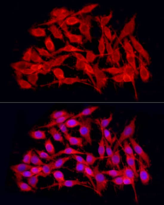 Immunocytochemistry/ Immunofluorescence: JMJD4 Antibody - BSA Free [NBP3-04727] - Immunofluorescence analysis of PC-12 cells using JMJD4 Rabbit pAb (A7992) at dilution of 1:100 (40x lens). Blue: DAPI for nuclear staining.