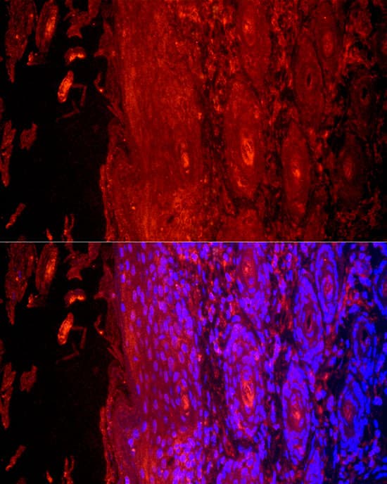 Immunocytochemistry/ Immunofluorescence: KRT9 Antibody - BSA Free [KRT9] - Immunofluorescence analysis of paraffin-embedded human skin using KRT9 Rabbit pAb  at dilution of 1:200 (40x lens). Secondary antibody: Cy3-conjugated Goat anti-Rabbit IgG (H+L)  at 1:500 dilution. Blue: DAPI for nuclear staining.Perform high pressure antigen retrieval with 0.01 M citrate buffer (pH 6.0) prior to IF staining.