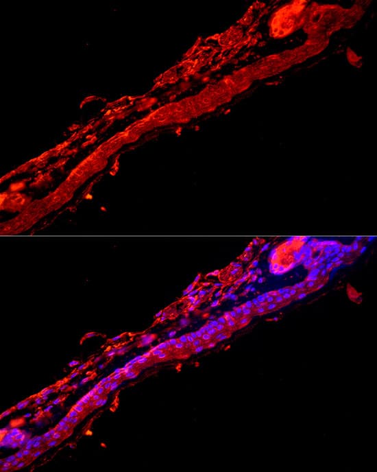 Immunocytochemistry/ Immunofluorescence KRT9 Antibody - BSA Free