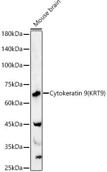 Western Blot: KRT9 Antibody - BSA Free [KRT9] - Western blot analysis of lysates from Mouse brain, using KRT9 Rabbit pAb  at  1:2000 dilution.Secondary antibody: HRP-conjugated Goat anti-Rabbit IgG (H+L)  at 1:10000 dilution.Lysates/proteins: 25ug per lane.Blocking buffer: 3% nonfat dry milk in TBST.Detection: ECL Basic Kit .Exposure time: 60s.