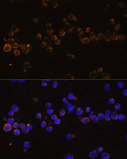 Immunocytochemistry/ Immunofluorescence KLRC4 Antibody - Azide and BSA Free