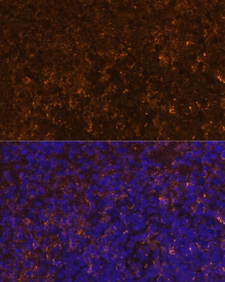 Immunocytochemistry/ Immunofluorescence KLRC4 Antibody - Azide and BSA Free