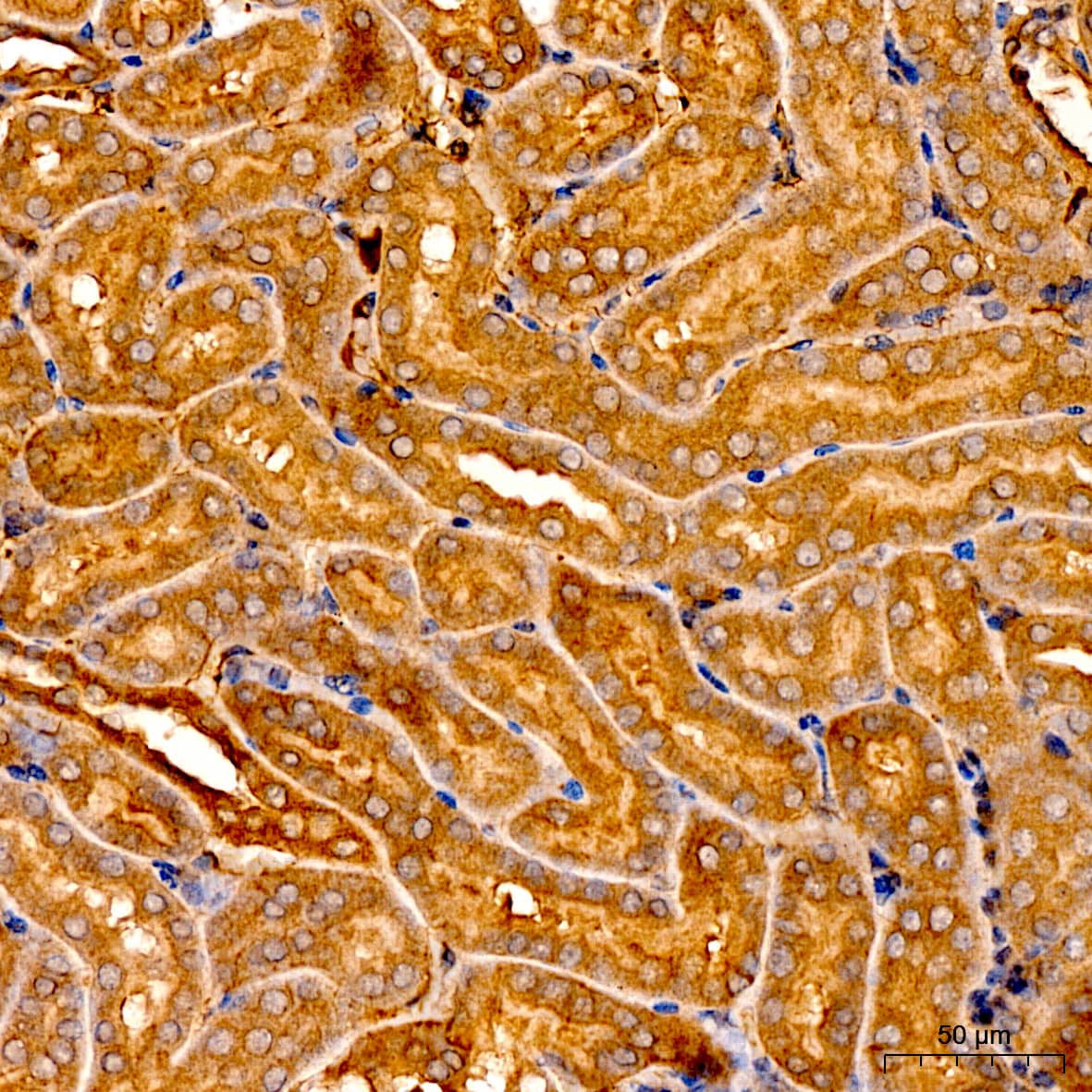 Immunohistochemistry LPCAT3 Antibody - Azide and BSA Free