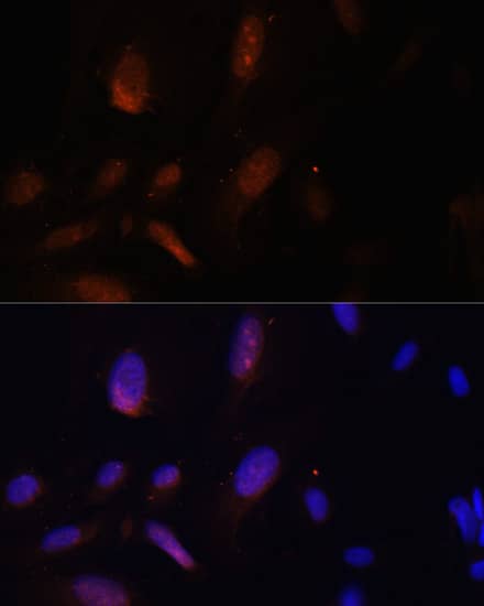 Immunocytochemistry/ Immunofluorescence ZNF574 Antibody - Azide and BSA Free